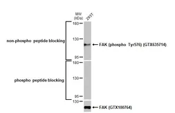 Anti-FAK antibody used in Western Blot (WB). GTX100764