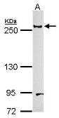 Anti-Laminin beta 1 antibody used in Western Blot (WB). GTX100787