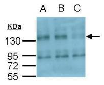 Anti-Integrin alpha V antibody [C2C3], C-term used in Western Blot (WB). GTX100789