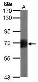 Anti-CD168 / RHAMM antibody used in Western Blot (WB). GTX100795