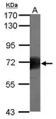 Anti-CD168 / RHAMM antibody used in Western Blot (WB). GTX100795