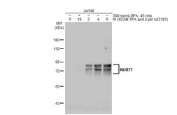 Anti-NUR77 antibody used in Western Blot (WB). GTX100797