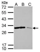 Anti-14-3-3 sigma antibody used in Western Blot (WB). GTX100801
