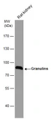 Anti-Granulins antibody used in Western Blot (WB). GTX100803