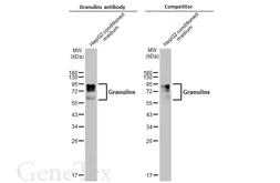 Anti-Granulins antibody used in Western Blot (WB). GTX100803