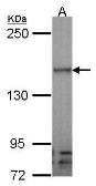 Anti-VEGF Receptor 3 antibody used in Western Blot (WB). GTX100807