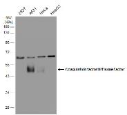 Anti-Coagulation factor III/Tissue Factor antibody [N1C3] used in Western Blot (WB). GTX100808