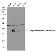 Anti-Coagulation factor III/Tissue Factor antibody [N1C3] used in Western Blot (WB). GTX100808