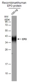 Anti-EPO antibody used in Western Blot (WB). GTX100813