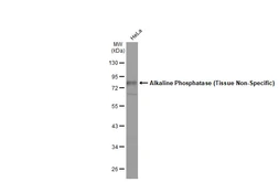 Anti-Alkaline Phosphatase (Tissue Non-Specific) antibody used in Western Blot (WB). GTX100817