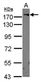 Anti-CD11b antibody [C1C3] used in Western Blot (WB). GTX100827