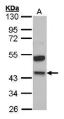 Anti-HMW Kininogen antibody used in Western Blot (WB). GTX100833