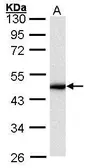 Anti-Cytokeratin 16 antibody [C2C3], C-term used in Western Blot (WB). GTX100838