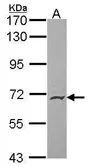 Anti-PODXL2 antibody [N3C3] used in Western Blot (WB). GTX100858
