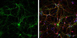 Anti-Synaptophysin antibody used in Immunocytochemistry/ Immunofluorescence (ICC/IF). GTX100865