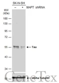 Anti-Tau antibody used in Western Blot (WB). GTX100866