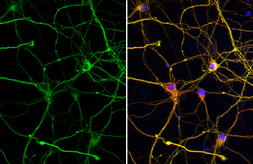 Anti-Tau antibody used in Immunocytochemistry/ Immunofluorescence (ICC/IF). GTX100866