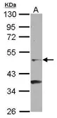 Anti-GCNF antibody [C1C3] used in Western Blot (WB). GTX100883
