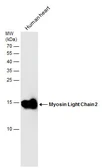 Anti-Myosin Light Chain 2 (MLC-2v) antibody used in Western Blot (WB). GTX100888