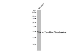 Anti-Thymidine Phosphorylase antibody used in Western Blot (WB). GTX100892