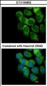 Anti-Thymidine Phosphorylase antibody used in Immunocytochemistry/ Immunofluorescence (ICC/IF). GTX100892