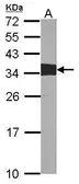 Anti-CRK antibody [N2C3] used in Western Blot (WB). GTX100901