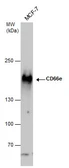 Anti-CD66e antibody used in Western Blot (WB). GTX100903