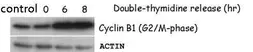 Anti-Cyclin B1 antibody used in Western Blot (WB). GTX100911