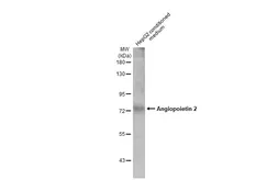 Anti-Angiopoietin 2 antibody used in Western Blot (WB). GTX100928