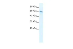 Anti-AChR alpha 7 antibody, Internal used in Western Blot (WB). GTX10096