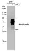 Anti-Amphiregulin antibody used in Western Blot (WB). GTX100986
