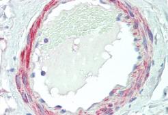 Anti-VPS35 antibody, C-term used in IHC (Paraffin sections) (IHC-P). GTX10099