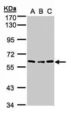 Anti-Angiopoietin 4 antibody used in Western Blot (WB). GTX100993