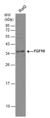 Anti-FGF10 antibody used in Western Blot (WB). GTX101005