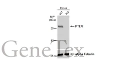 Anti-PTEN antibody used in Western Blot (WB). GTX101025