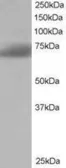 Anti-SH3BP1 antibody, C-term used in Western Blot (WB). GTX10103