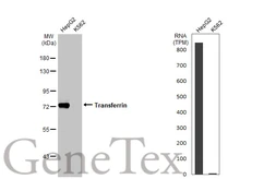 Anti-Transferrin antibody [N3C3] used in Western Blot (WB). GTX101035