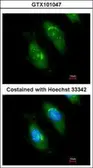 Anti-SMN1 antibody used in Immunocytochemistry/ Immunofluorescence (ICC/IF). GTX101047