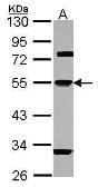 Anti-alpha 1 Antitrypsin antibody [N3C3] used in Western Blot (WB). GTX101054