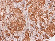 Anti-SEC13L1 antibody [N1C3] used in IHC (Paraffin sections) (IHC-P). GTX101055