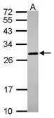 Anti-Prion Protein (PrP) antibody used in Western Blot (WB). GTX101063