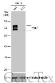 Anti-PSAP antibody [N1N3] used in Western Blot (WB). GTX101064