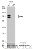 Anti-PSAP antibody [N1N3] used in Western Blot (WB). GTX101064