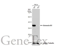 Anti-Annexin A1 antibody used in Western Blot (WB). GTX101070
