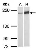 Anti-WRN antibody [C3], C-term used in Western Blot (WB). GTX101082
