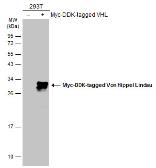 Anti-Von Hippel Lindau antibody used in Western Blot (WB). GTX101087