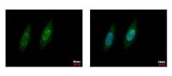 Anti-VCP antibody used in Immunocytochemistry/ Immunofluorescence (ICC/IF). GTX101089