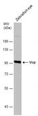 Anti-VCP antibody used in Western Blot (WB). GTX101089