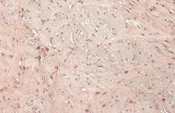 Anti-UBE3A antibody used in IHC (Paraffin sections) (IHC-P). GTX101092
