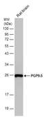 Anti-PGP9.5 antibody used in Western Blot (WB). GTX101093